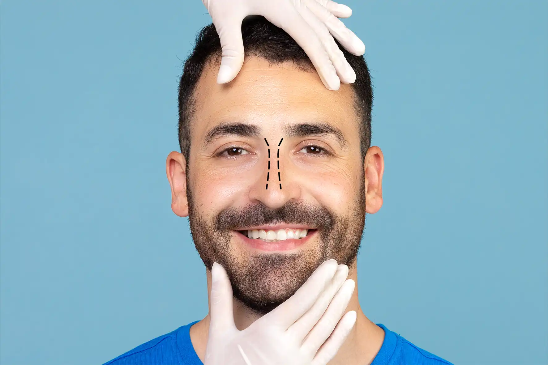 erkek burun estetiği nasıl yapılır